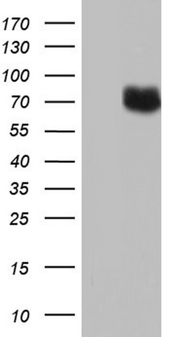 PTGS2 / COX2 / COX-2 Antibody (aa18-260, clone OTI6D10, Carrier-free)