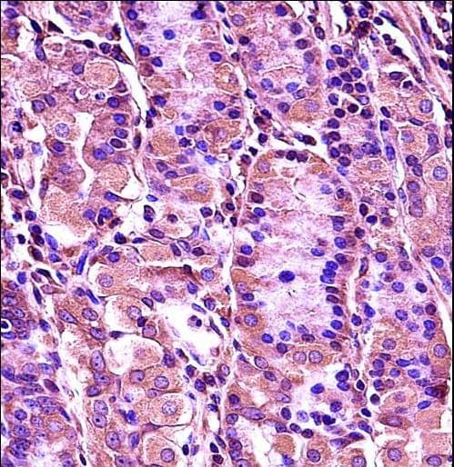 SYT1 / Synaptotagmin Antibody (aa349-377)