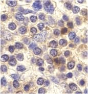 Polyclonal Rabbit anti-Human CX3CR1 Antibody (IHC, IF, WB)