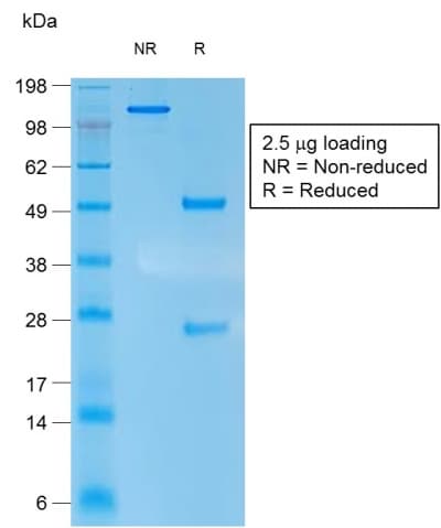 Recombinant Monoclonal Mouse anti-Human KRT10 / CK10 / Cytokeratin 10 Antibody (clone rKRT10/1275, IHC)