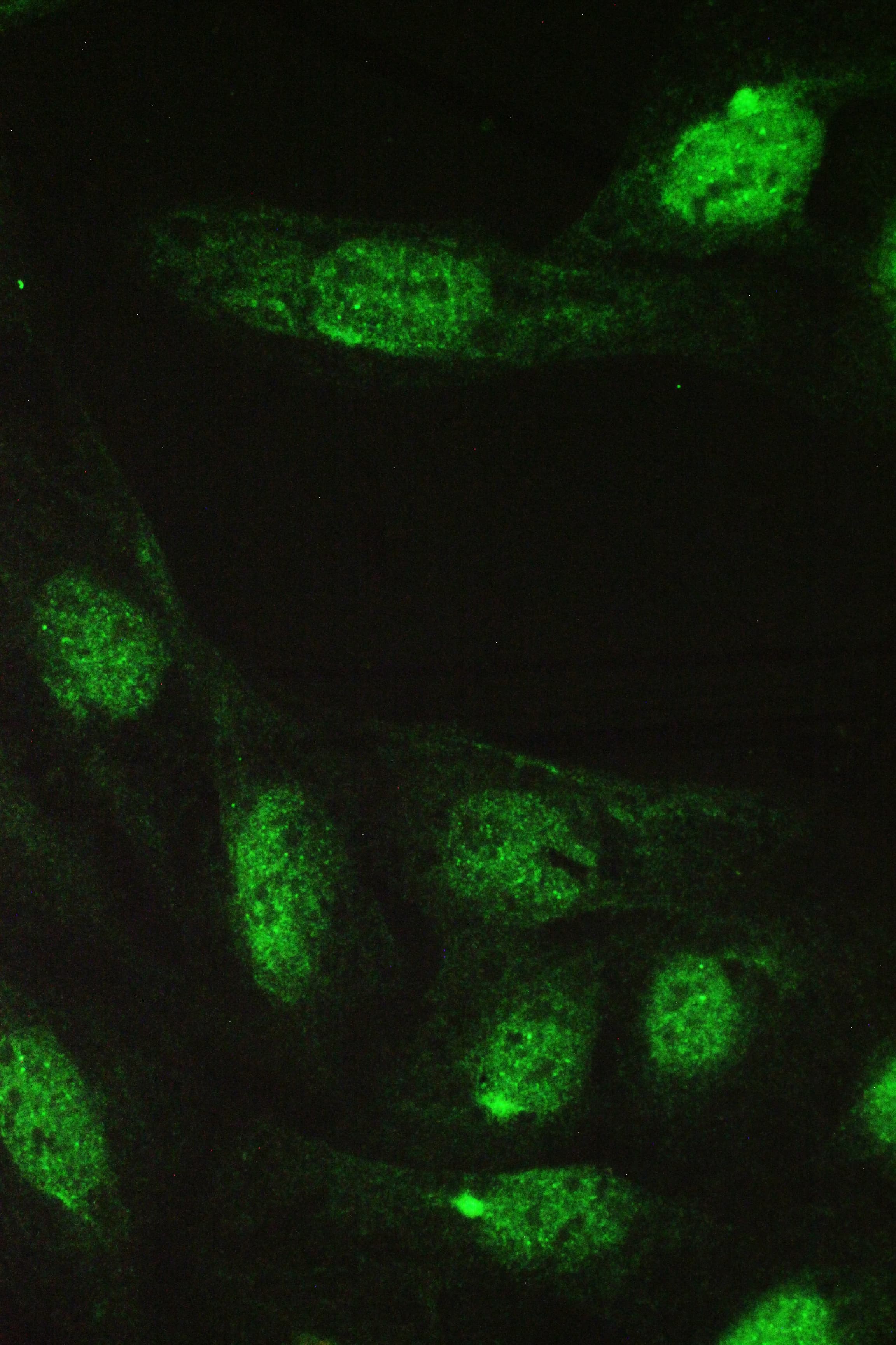 CCT5 / TCP1 Epsilon Antibody