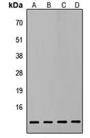 Polyclonal Rabbit anti-Human ATP5L2 Antibody (Internal, IF, WB)