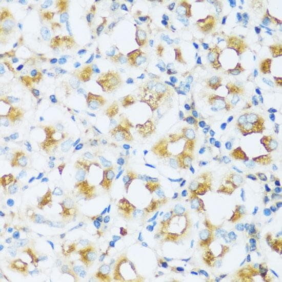 Polyclonal Rabbit anti-Human APOD / Apolipoprotein D Antibody (IHC)