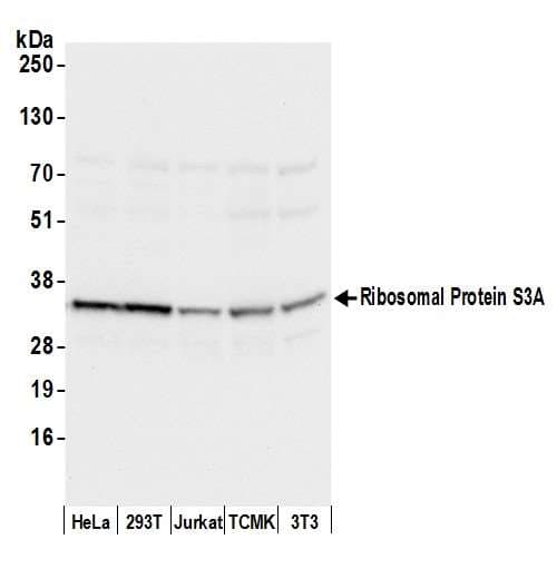 RPS3A / Ribosomal Protein S3A Antibody (aa175-225)