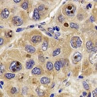ATP5B / ATP Synthase Beta Antibody