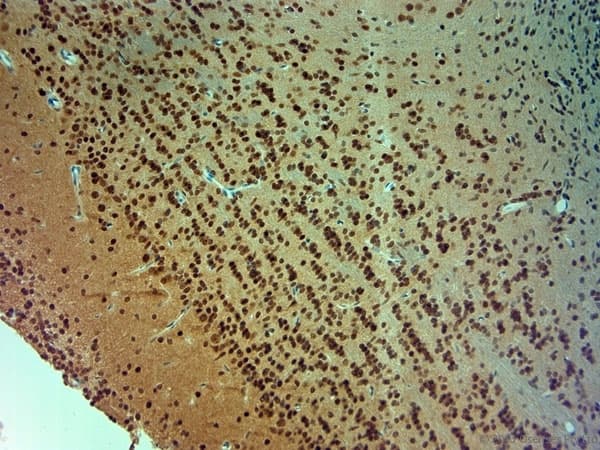ARX Antibody (aa2-50)