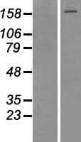 TOP2A / Topoisomerase II Alpha Protein (Over-Expression Lysate Myc-DDK (Flag))