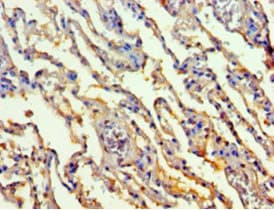 Polyclonal Rabbit anti-Human Transaldolase Antibody (IHC, WB)