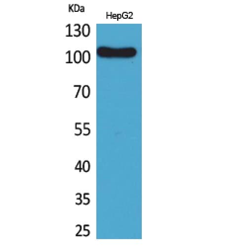 FCRL5 / CD307 Antibody (181-230 aa, Internal)