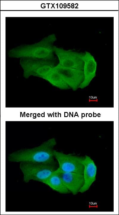 PGAM2 Antibody (aa1-253)