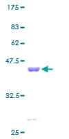 Human RPS12 / Ribosomal Protein S12 (Recombinant GST)