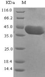 Rift Valley Fever Virus SARS-CoV Nucleoprotein (Recombinant 6His-SUMO, N-terminus)