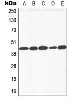 GALK1 / GK1 Antibody (N-Terminus)