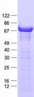 Human PPP2R5D Protein (Recombinant His, N-Terminal)