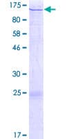 Human CTAGE1 / CTAGE Protein (Recombinant GST)