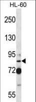 SECISBP2 / SBP2 Antibody (aa501-530)
