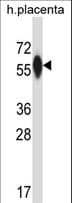 P4HA3 Antibody (aa274-303)