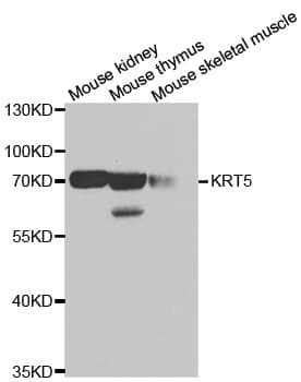 Polyclonal Rabbit anti-Human KRT5 / CK5 / Cytokeratin 5 Antibody (IHC, IF, WB)
