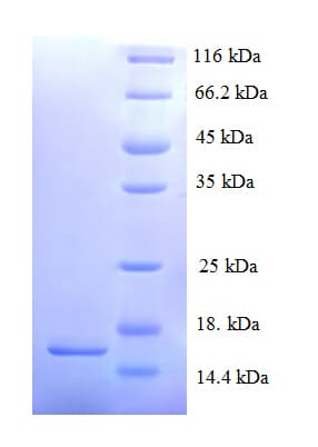 Mouse SAA2 / Serum Amyloid A2 Protein (Recombinant His)