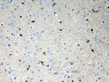HCN2 Antibody
