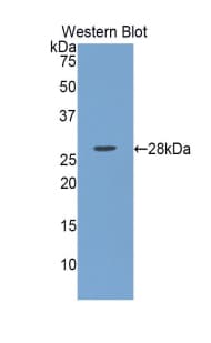 LOXL1 Antibody (aa392-598)