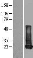 RBP1 / CRBP Protein (Over-Expression Lysate Myc-DDK (Flag))