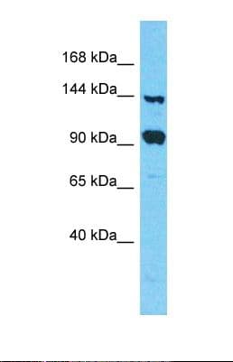 FAM193A Antibody (aa1132-1181)