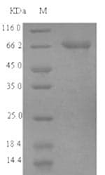 Human ACSF2 Protein (Recombinant 6His, N-terminus)