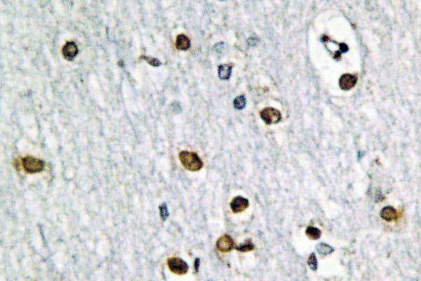 GTF2A1 / TFIIA Antibody (Glu311)
