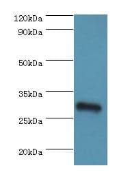 Polyclonal Rabbit anti-Human GS28 / GOSR1 / p28 Antibody (aa1-115, IHC, WB)