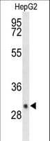 Polyclonal Rabbit anti-Human DIO3 Antibody (aa250-278, IHC, WB)
