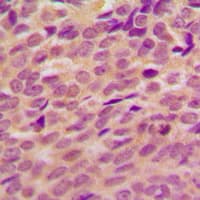 Polyclonal Rabbit anti-Human BRCA1 Antibody (phospho-Ser1524, IHC, WB)