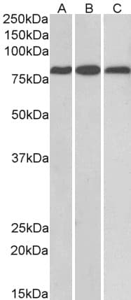 IHC-plus™ TRIM1 / MID2 Antibody (aa723-735)