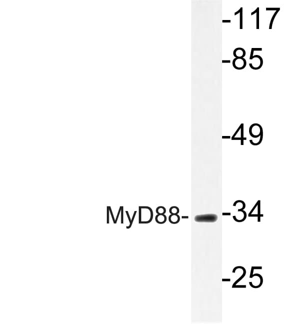 MYD88 Antibody (Val220)