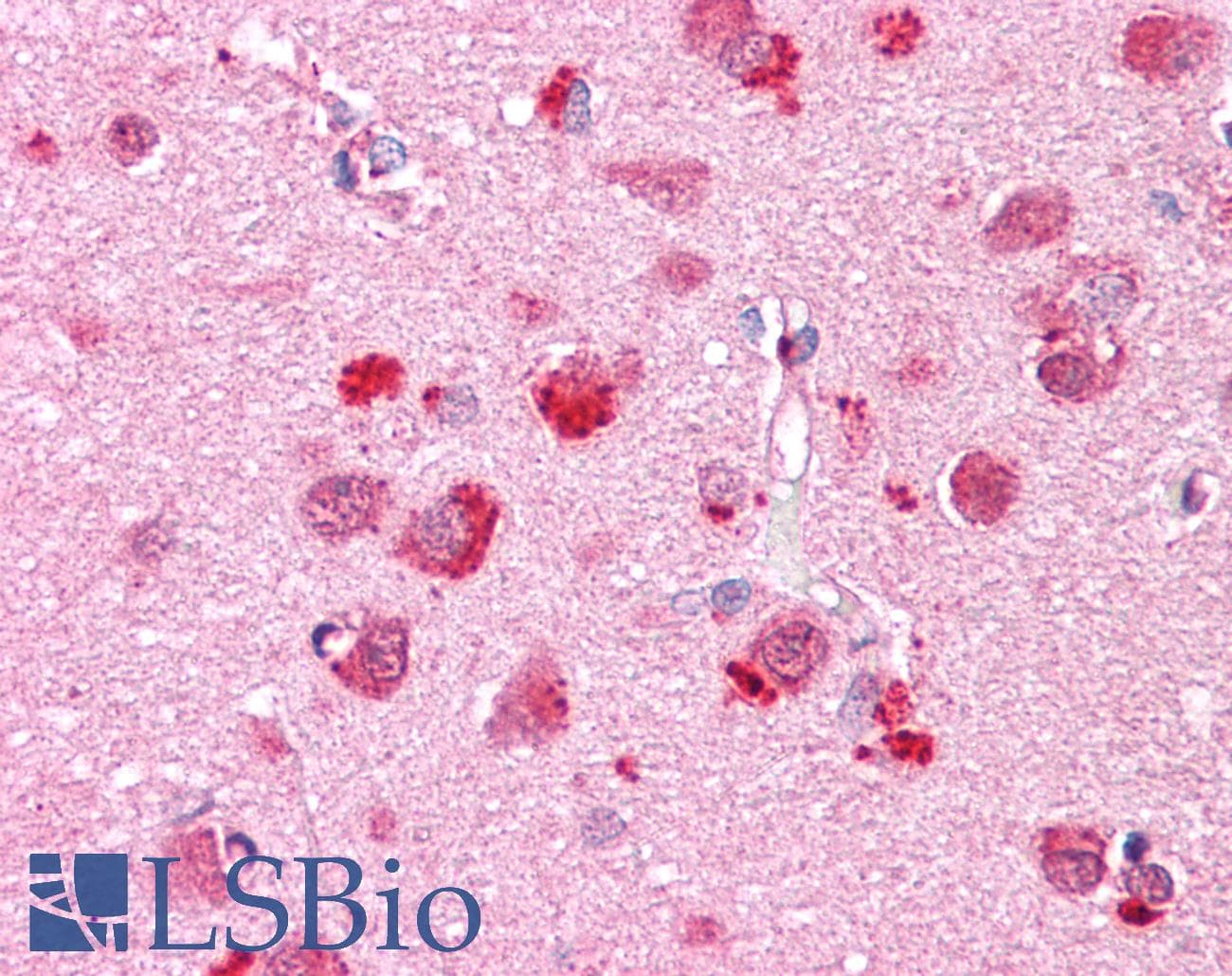 IHC-plus™ CHN2 / Chimerin 2 Antibody (C-Terminus)