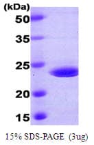 Human CRADD / RAIDD Protein (Recombinant His)