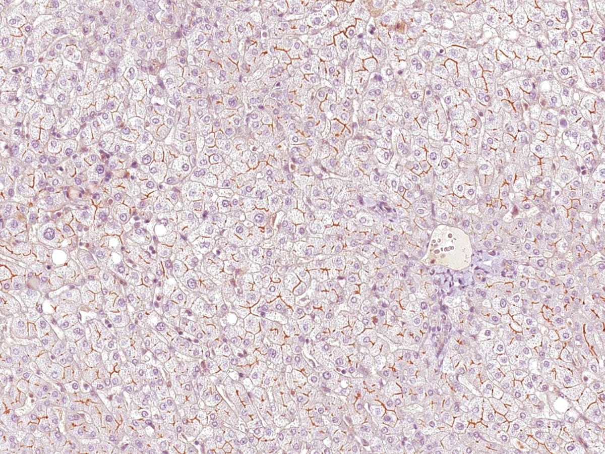 IHC-plus™ ABCB4 / MDR3 Antibody (Concentrated)