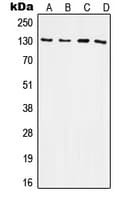 ITGB3 / Integrin Beta 3 / CD61 Antibody (C-Terminus)