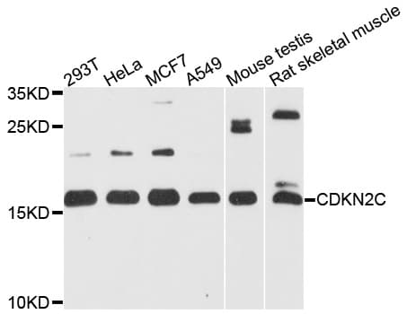 CDKN2C / p18 INK4c Antibody