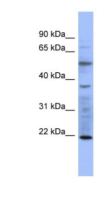 MYL3 Antibody (aa35-84)