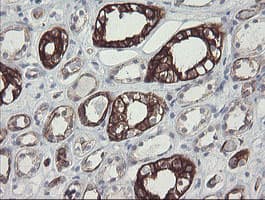 SLA2 / SLAP2 Antibody (clone OTI3A7)