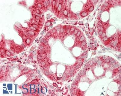 IHC-plus™ Polyclonal Rabbit anti-Human PDIA6 / ERP5 Antibody (IHC, IF, WB)