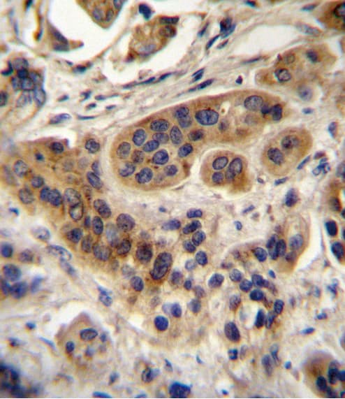 ACOX1 / ACOX Antibody (aa7-37)