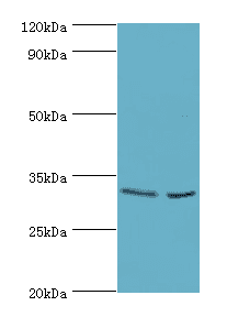 CA8 / Carbonic Anhydrase VIII Antibody (aa1-290)