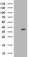 RASSF1 / RASSF1A Antibody (clone OTI8A11)