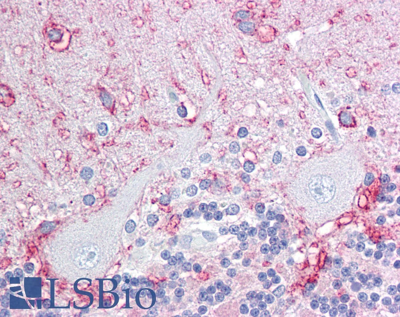 IHC-plus™ ANOS1 / Anosmin Antibody