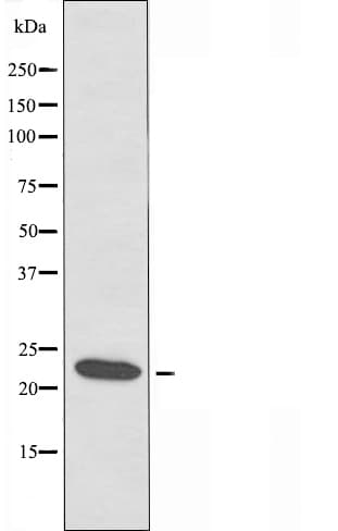 CLDN19 / Claudin 19 Antibody