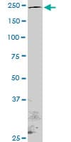 NOTCH1 Antibody (clone 4G1)
