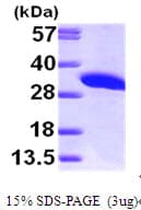 Human IMPA1 / IMP Protein (Recombinant His)