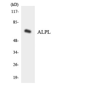 Polyclonal Rabbit anti-Human ALPL / Alkaline Phosphatase Antibody (aa188-237, WB)